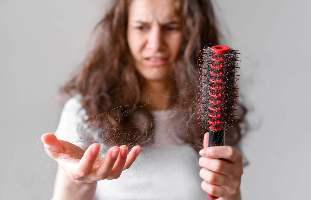 Female Hair Transplantation