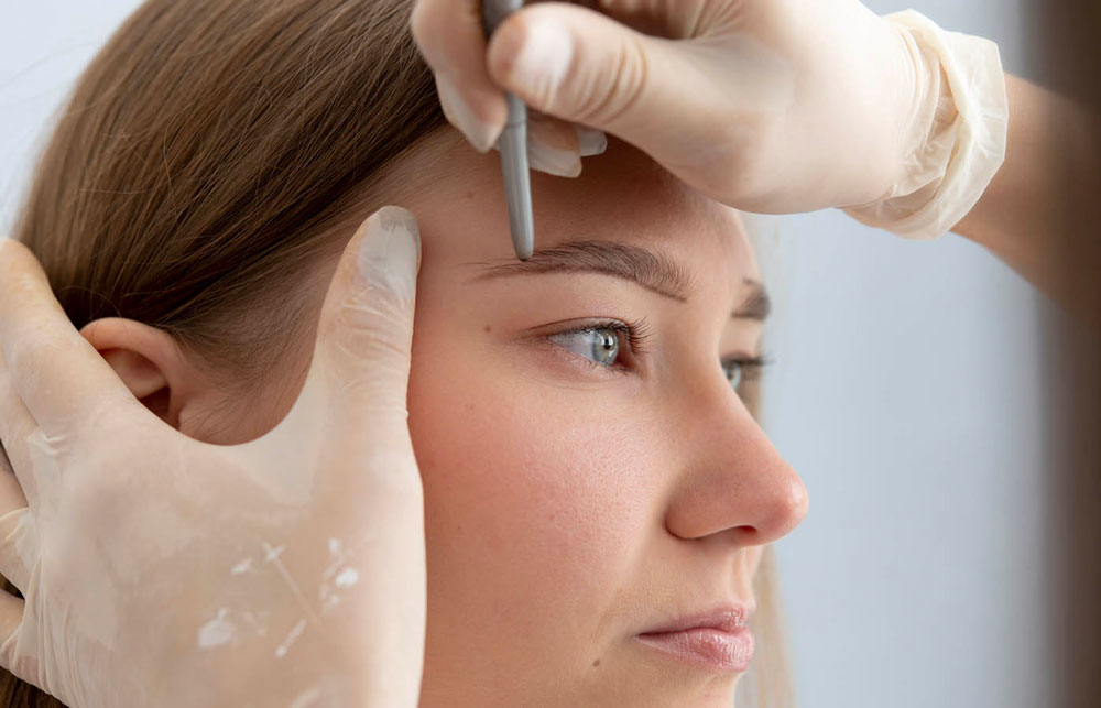 Eyebrow Hair Transplantation