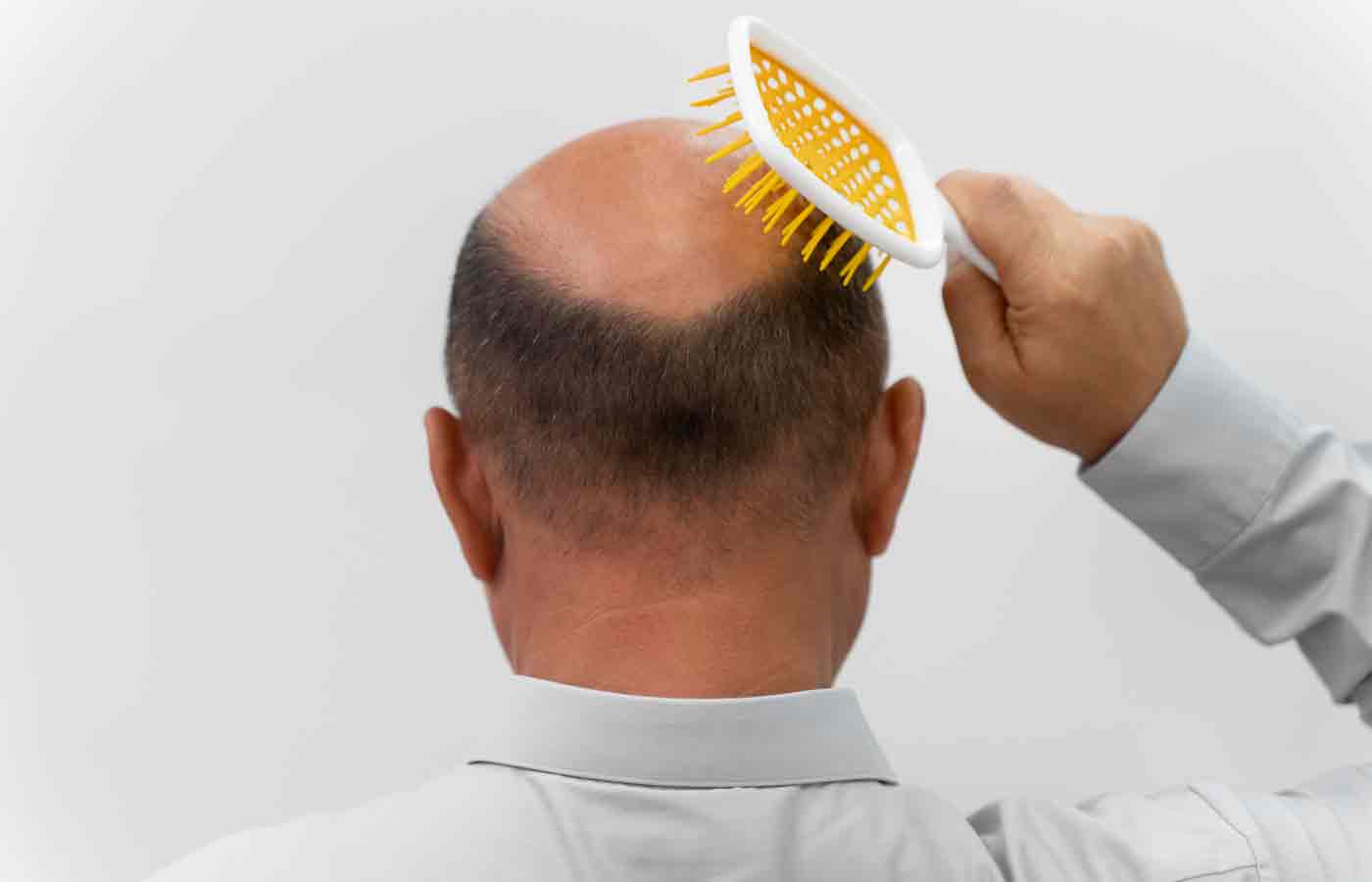 Male Hair Fall Treatment