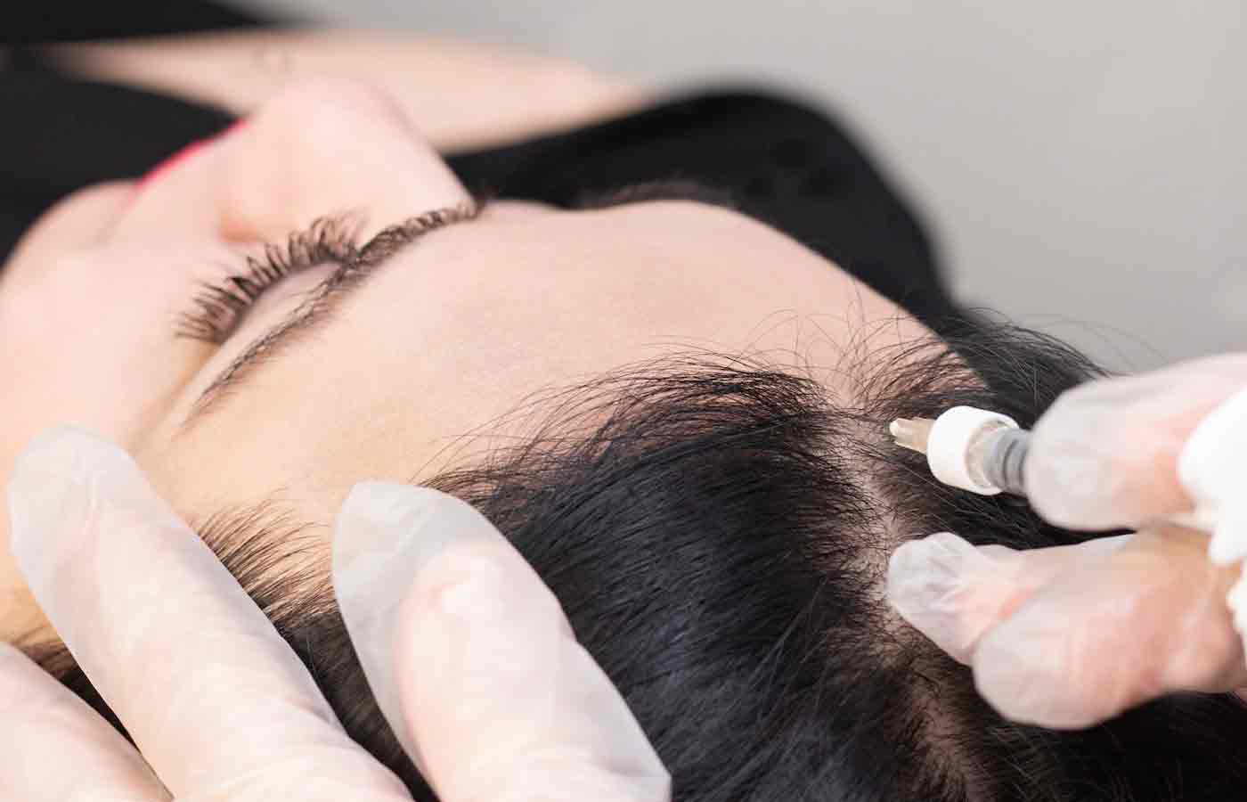 Female Hair Line Repair